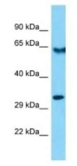 OR10R2 Rabbit anti-Human, Polyclonal, Novus Biologicals 100 &mu;g; Unconjugated:Antibodies,